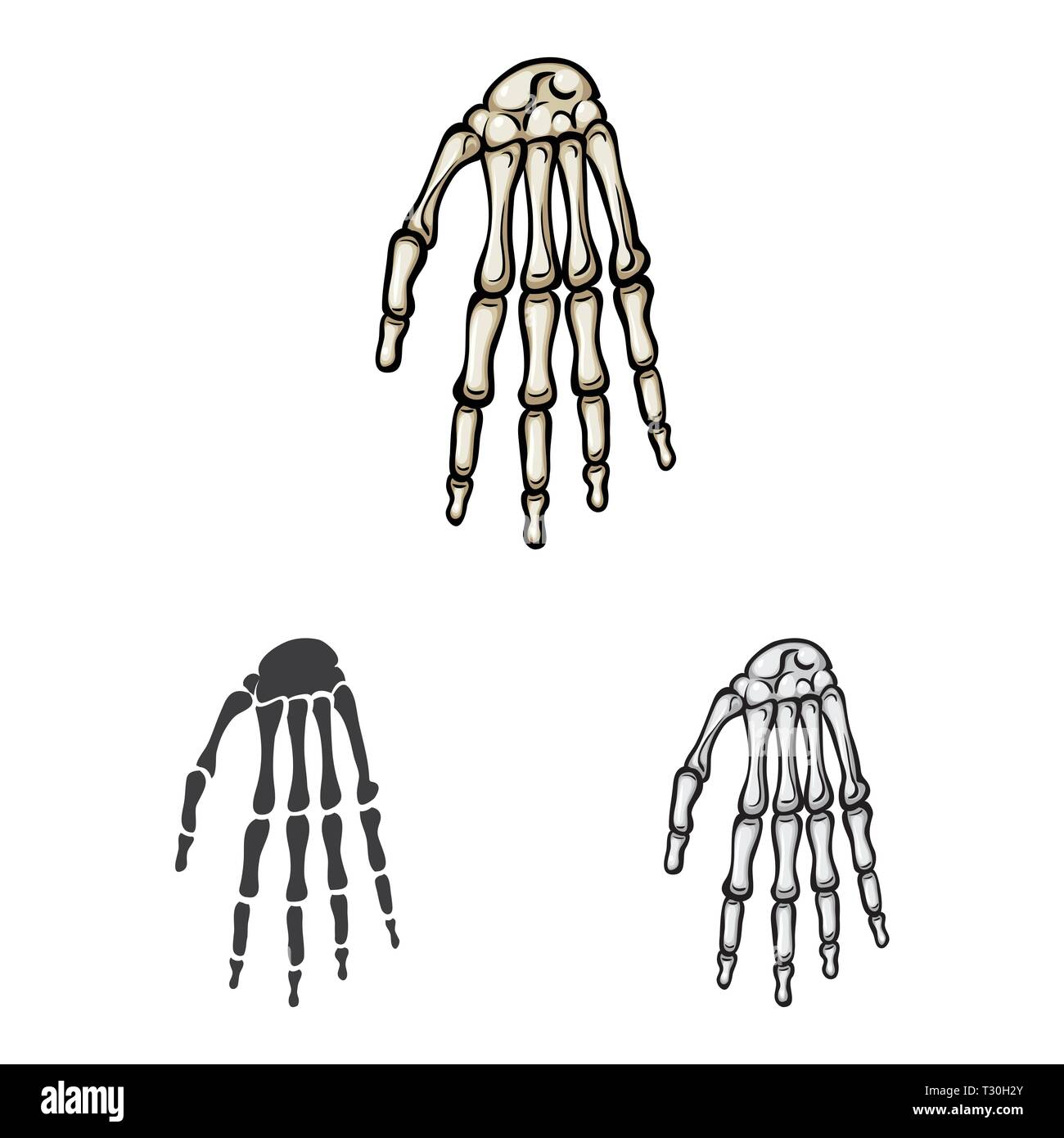 wrist,hand,calcium,structure,arm,carpus,health,xray,finger,injury ...