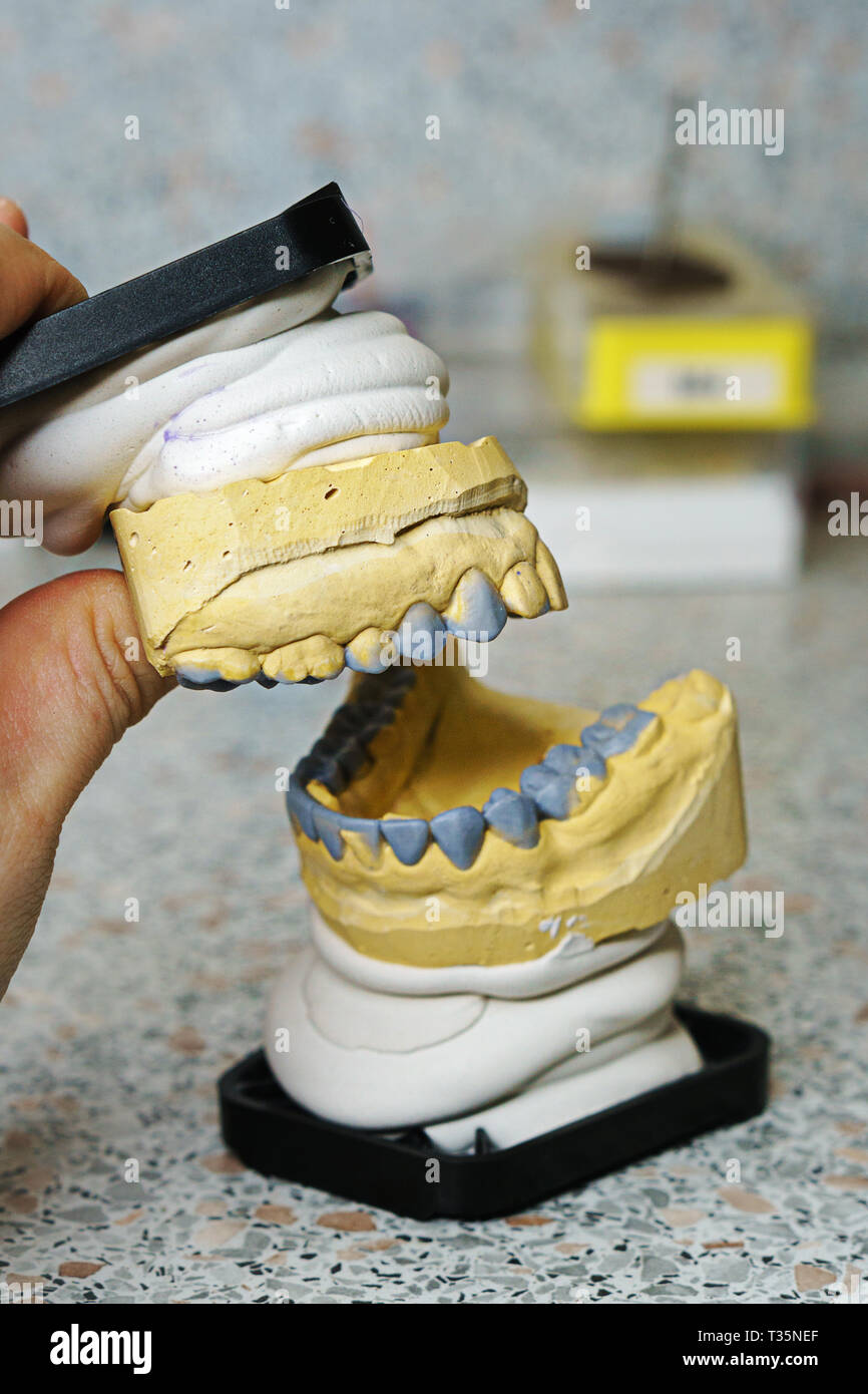 Dental impressions of teeth for manufacture of prostheses and ...