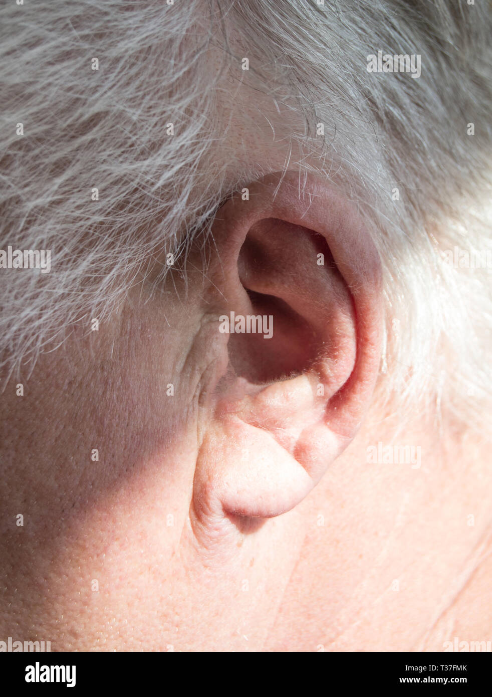 Left Ear Of A Gray Haired Elderly Man With Hearing Loss Hearing Problems The Concept Of