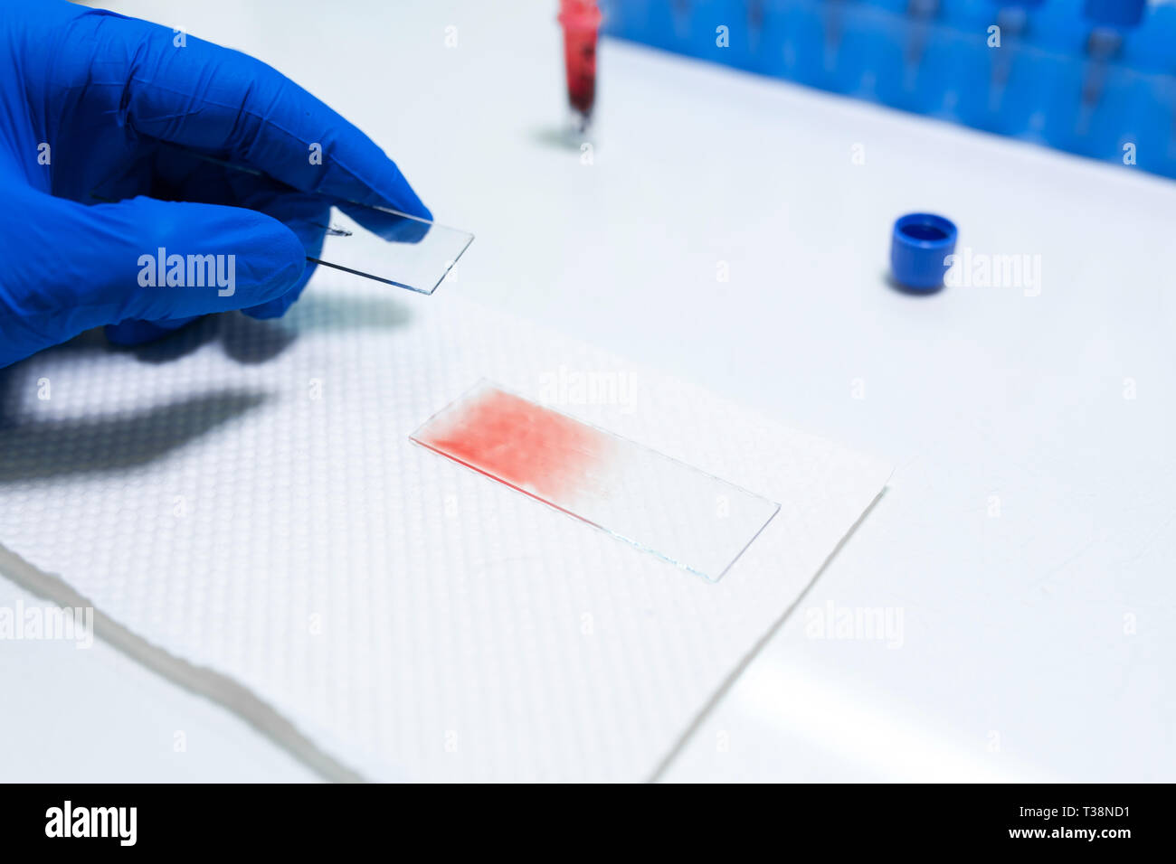 scientist prepare blood sample for research on microscope. Placing