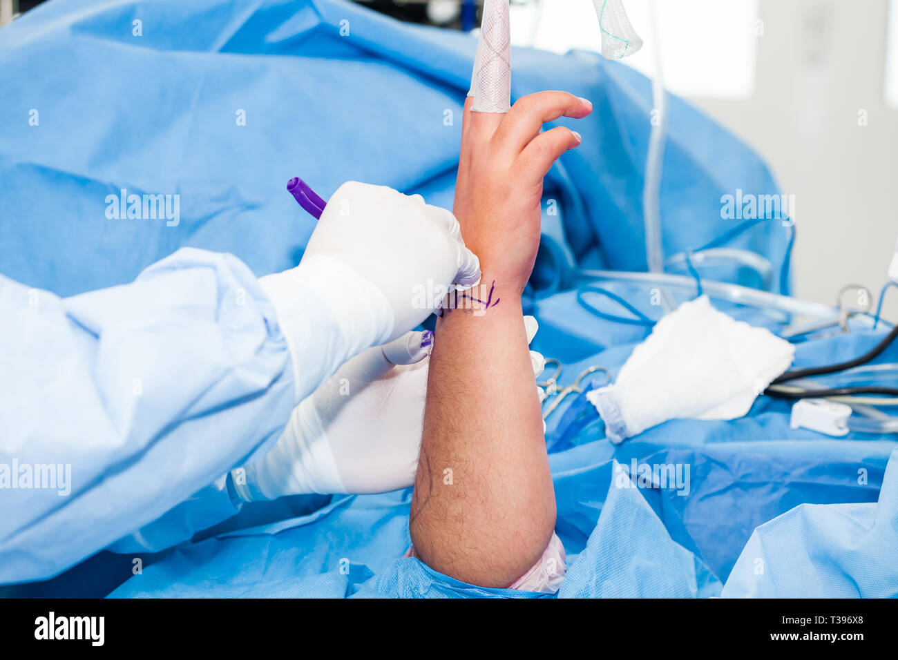 Orthopedic surgeon marking the surgical site just before performing a