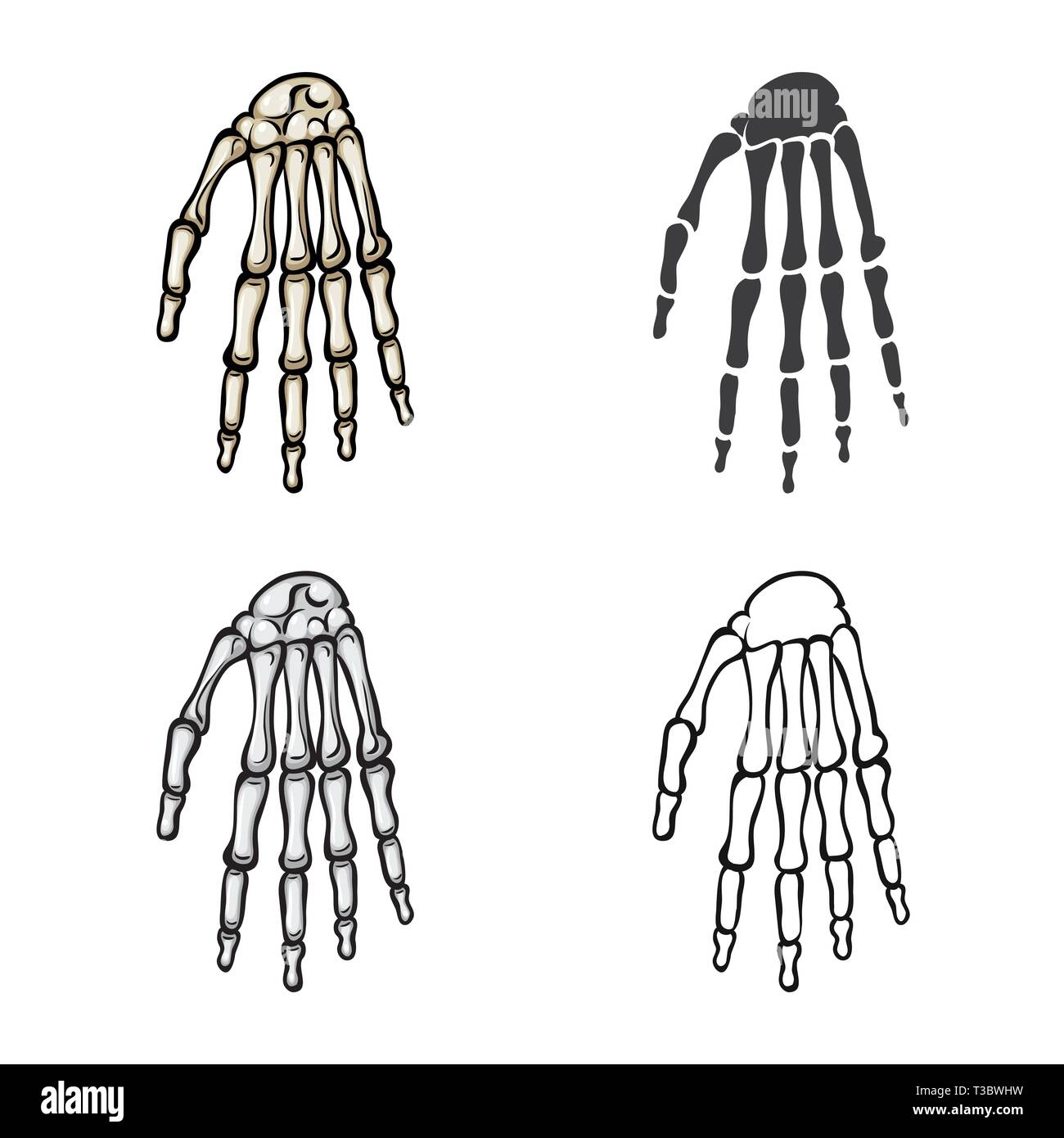 wrist,hand,calcium,structure,arm,carpus,health,xray,finger,injury ...