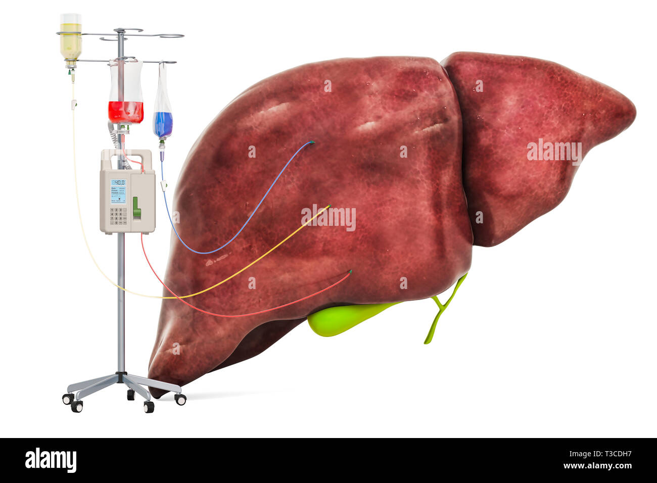 Intravenous therapy system with human liver. Treatment of liver diseases concept, 3D rendering isolated on white background Stock Photo