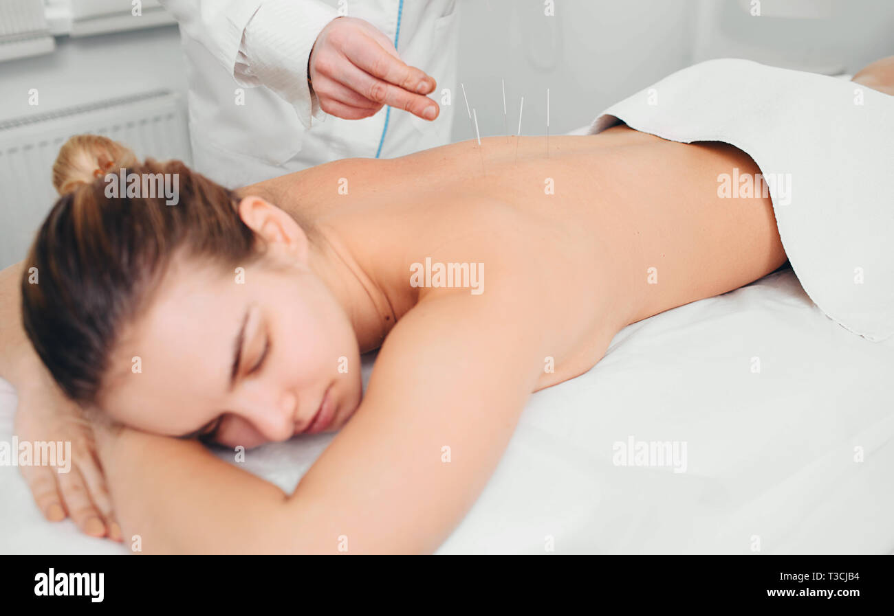 Acupuncturist inserting a needle into a female back. patient having traditional Chinese treatment using needles to restore an energy flow through spec Stock Photo