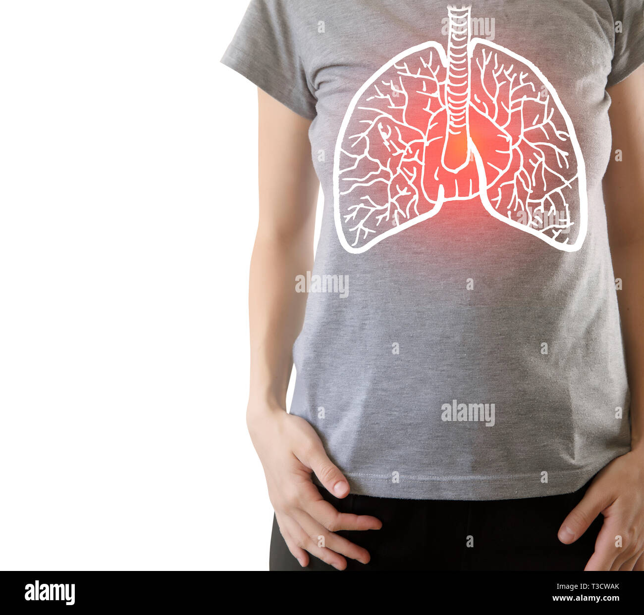 Page 3 - Lung cancer High Resolution Stock Photography and Images - Alamy