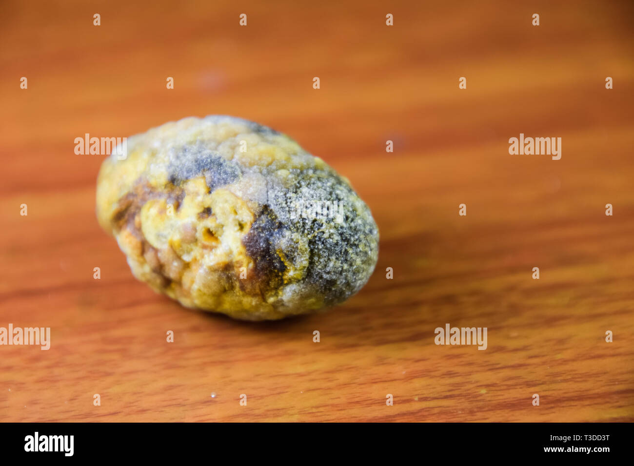 Large gallstone, Gall bladder stone. The result of gallstones. A calculus of heterogeneous composition on a brown background Stock Photo