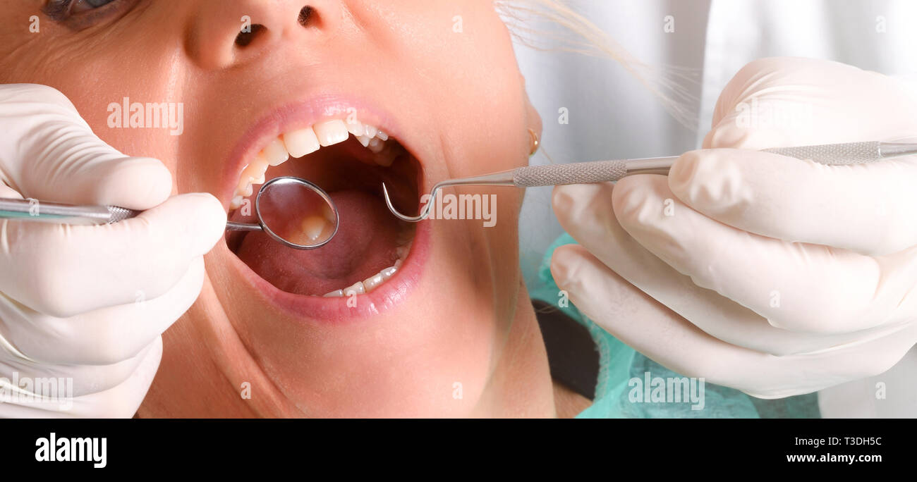 Dentist with white latex gloves examining the mouth of a blonde woman