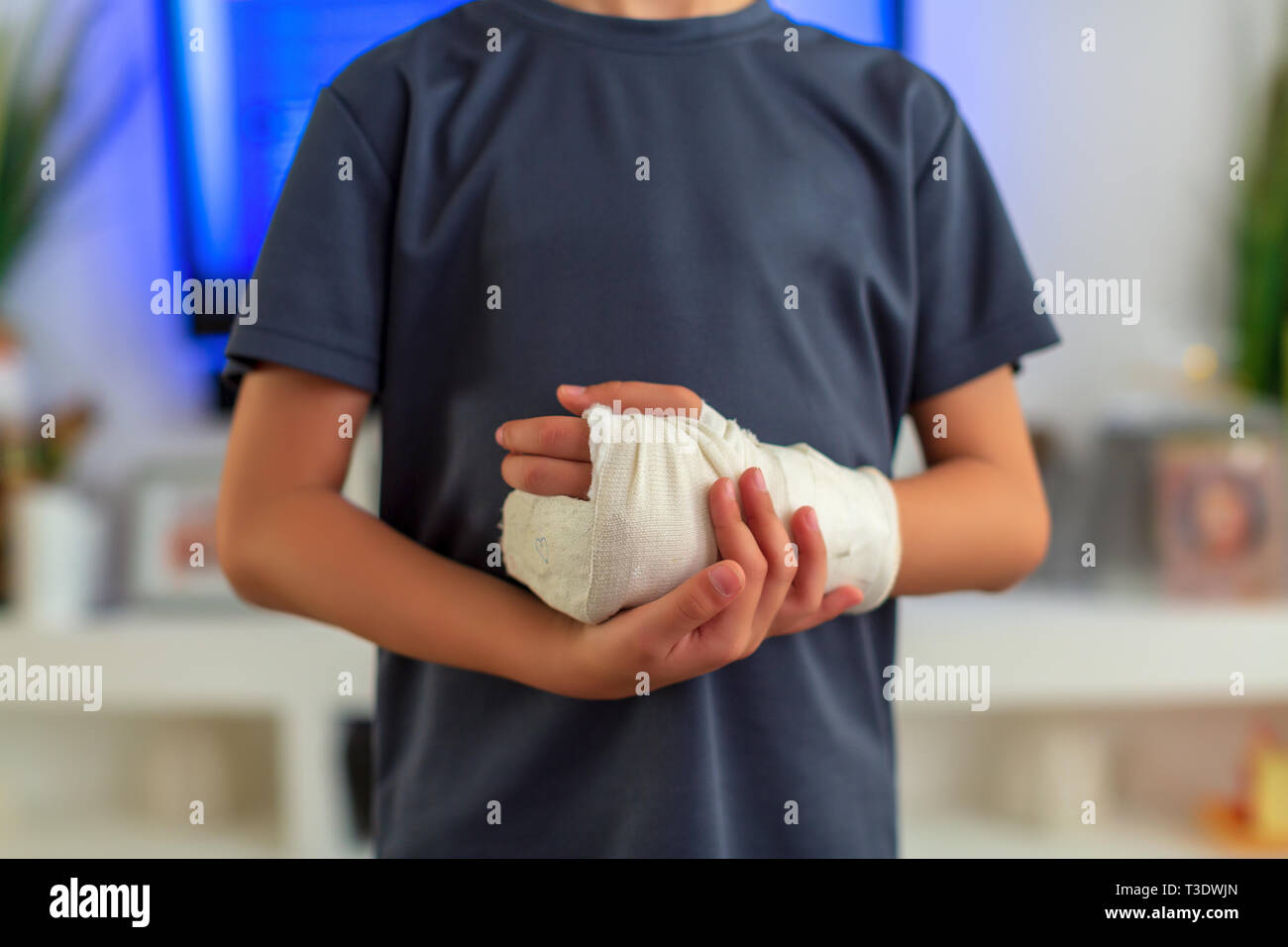 little boy in a cast.child with a broken arm. funny kid after injury Stock Photo
