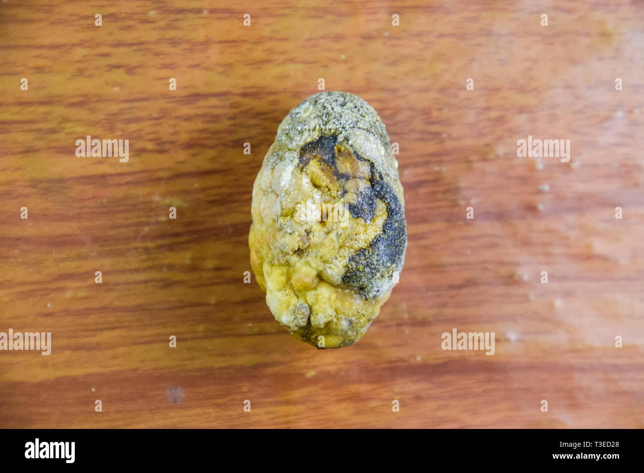 Large gallstone, Gall bladder stone. The result of gallstones. A calculus of heterogeneous composition on a brown background Stock Photo