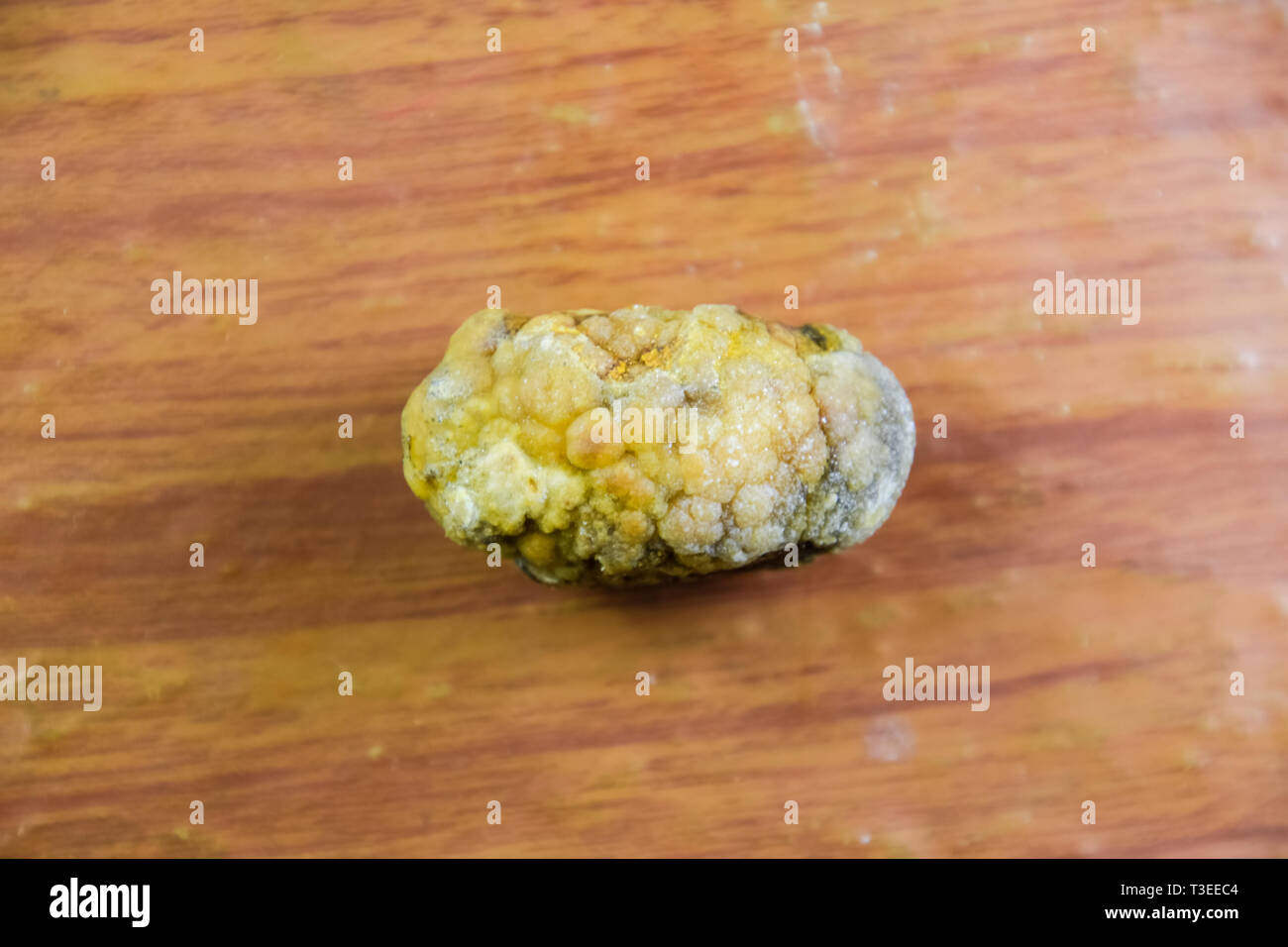 Large gallstone, Gall bladder stone. The result of gallstones. A calculus of heterogeneous composition on a brown background Stock Photo