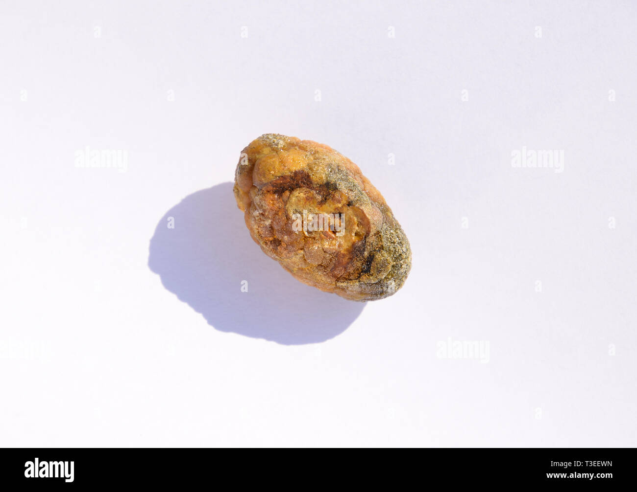 Stone of the gallbladder. The result of gallstones. A calculus of
