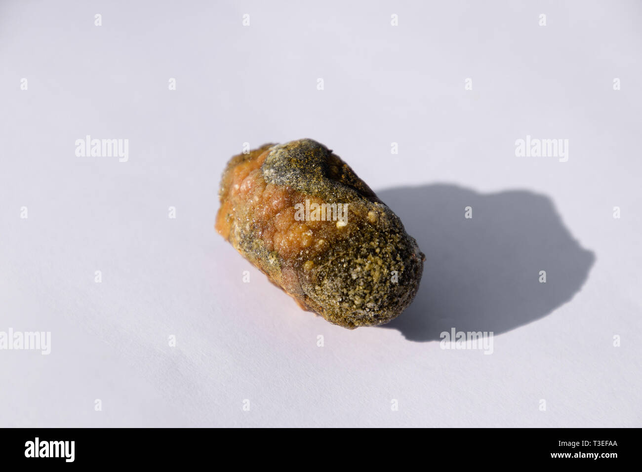 Stone of the gallbladder. The result of gallstones. A calculus of heterogeneous composition. Stock Photo