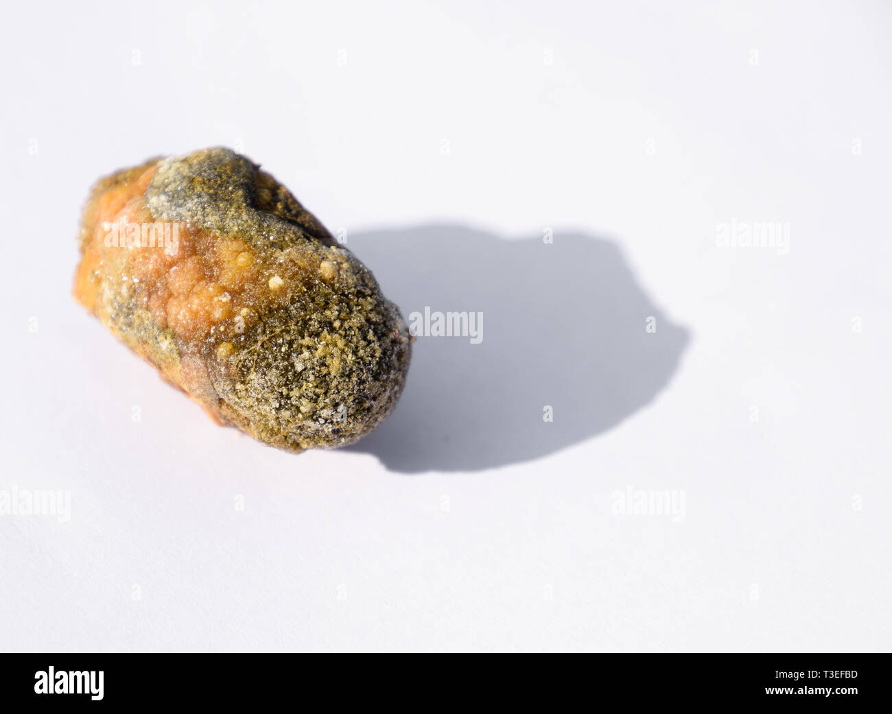 Stone of the gallbladder. The result of gallstones. A calculus of heterogeneous composition. Stock Photo