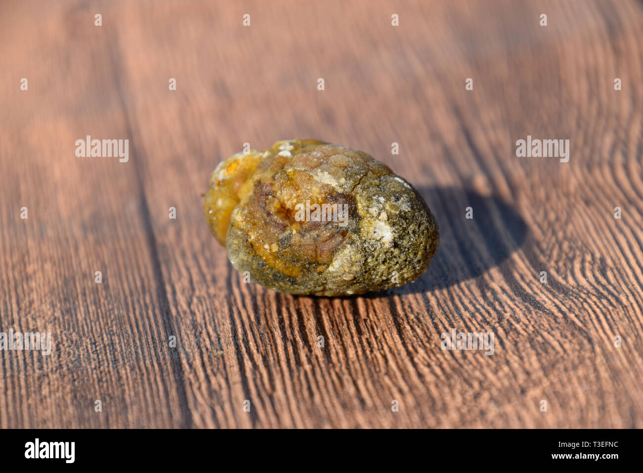 Stone of the gallbladder. The result of gallstones. A calculus of dissimilar composition on a wooden background. Stock Photo