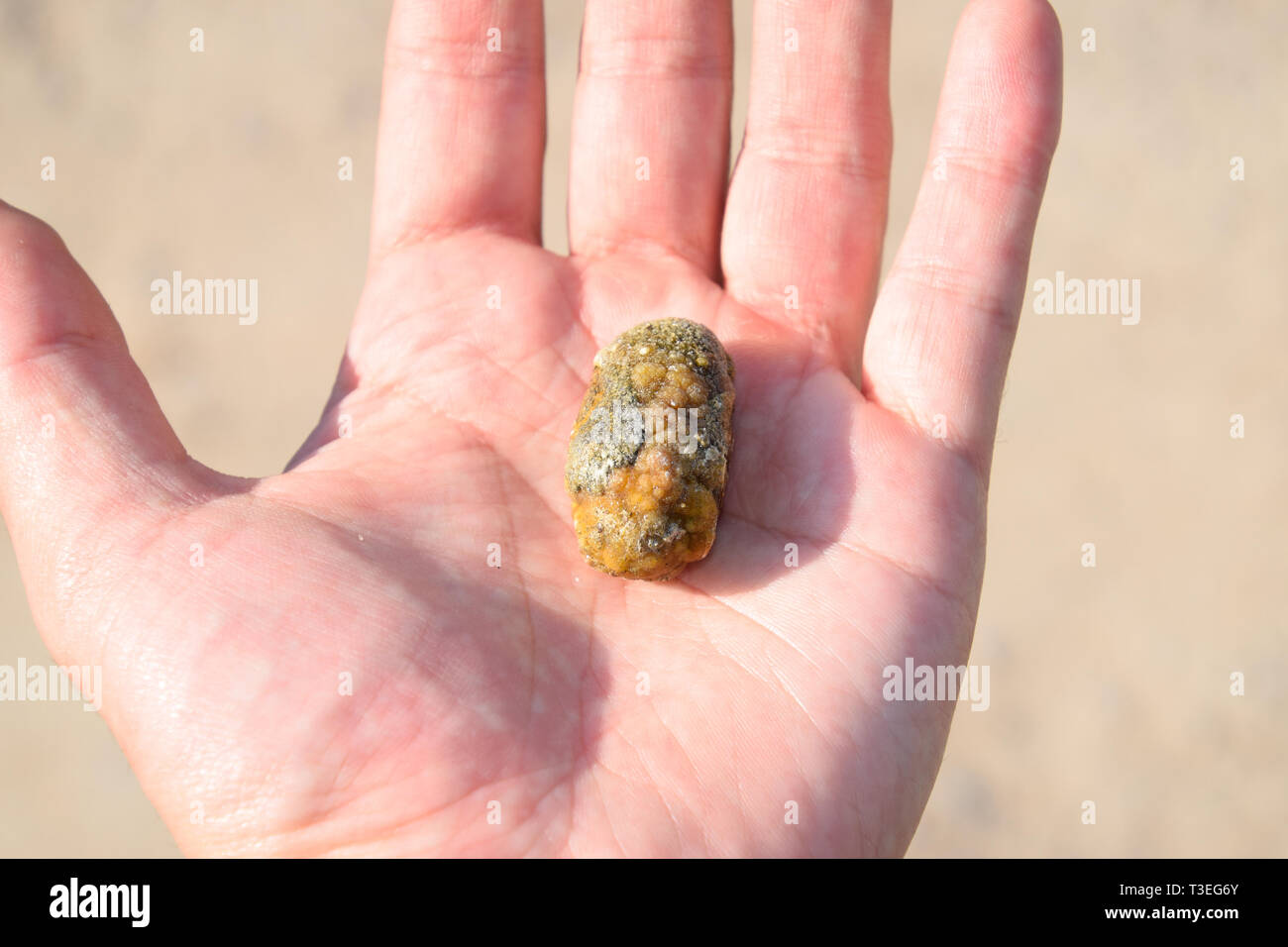 Gallstone in hand, Gall bladder stone. The result of gallstones. Calculus of heterogeneous composition Stock Photo