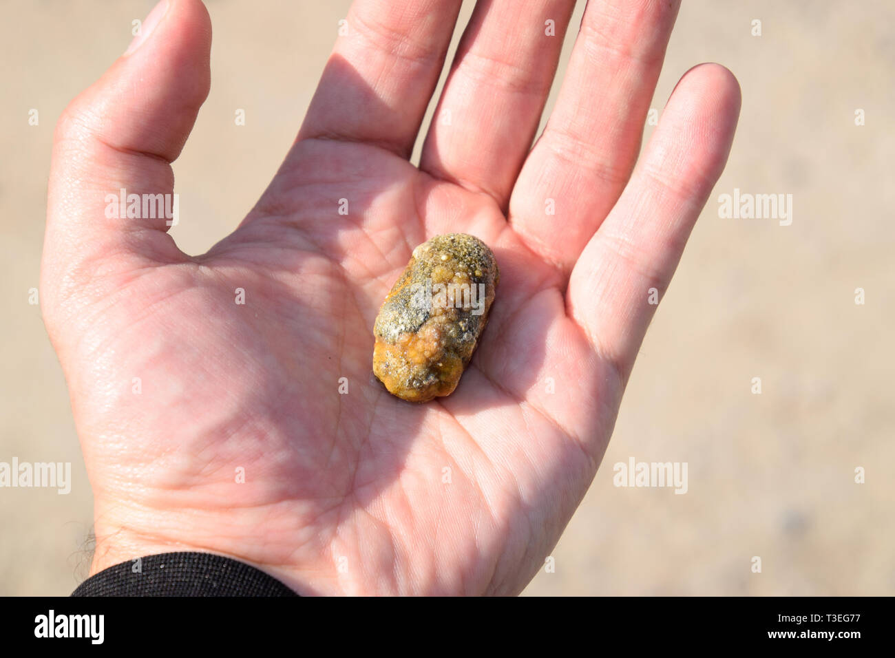 Gallstone in hand, Gall bladder stone. The result of gallstones
