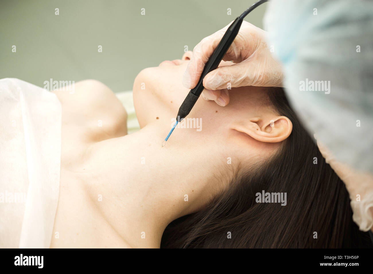 Electrocautery hi-res stock photography and images - Alamy