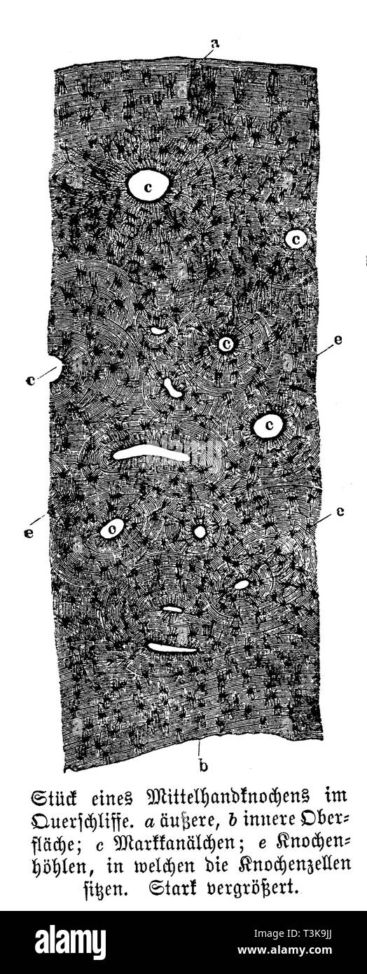 Human: piece of a cross section of a metacarpal bone. a) outer, b) inner surface; c) medullary canals; e) bone cavities in which the bone cells are located., anonym Stock Photo