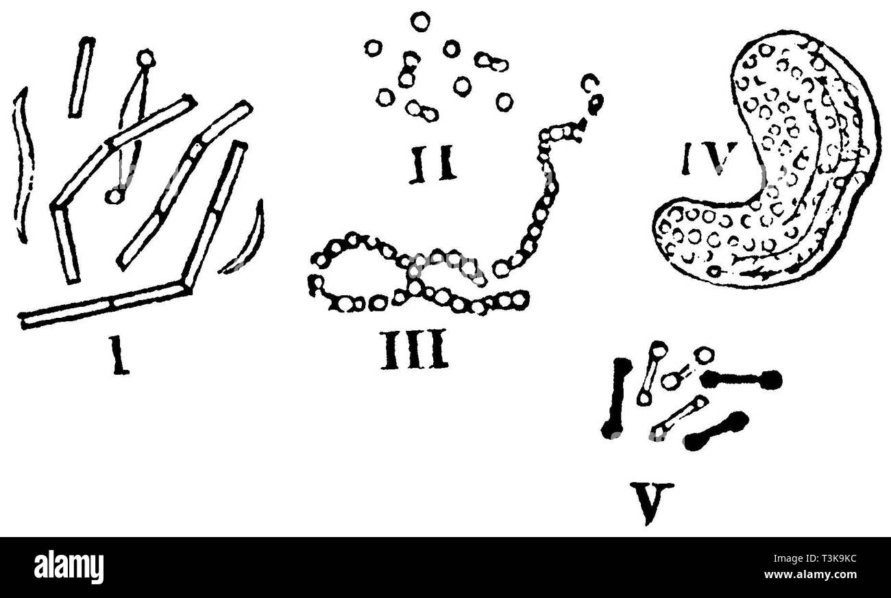 I. Bacteria. II. Vibrions. III. Leptotbrix chain. IV. Zoogloea cholerae jellyfish. V. Sporonema gracile, anonym Stock Photo