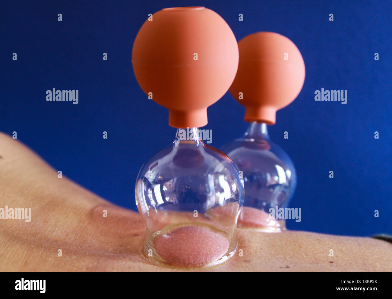 Dry cupping hires stock photography and images Alamy
