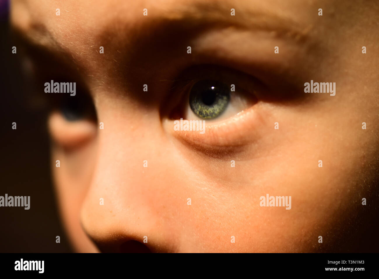 I have very poor eyesight. Little boy with poor eye health. Small boy in contact lens. Childhood health. Eyesight checkup at oculist. Eye test at Stock Photo