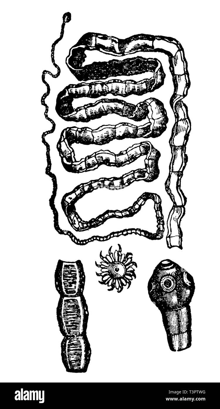 Chain tapeworm, anonym 1887 Stock Photo Alamy
