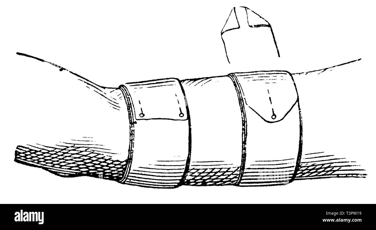 Simple bandage, anonym  1887 Stock Photo