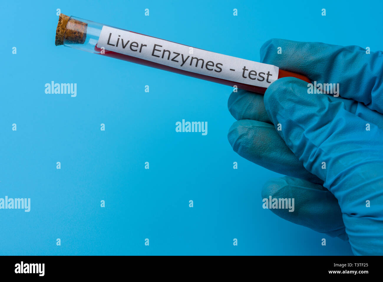 Liver enzyme test hires stock photography and images Alamy