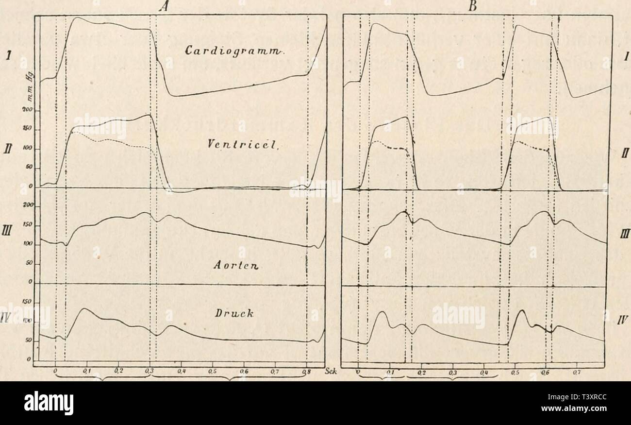 Archive image from page 151 of Die Physiologie des Kreislaufes (1921). Die Physiologie des Kreislaufes  diephysiologiede01tige Year: 1921  140 Die mechanischen Leistungen des Herzens. Das Herz kann nun ohne Schwierigkeit eine große Blutmenge heraustreiben, und der Druck steigt in der Aorta schnell an. Das ausgetriebene Blut entleert sich aber leicht in die peripheren Gefäße und in die Venen, und infolgedessen kann eine nennenswerte Steigerung des Aortadruckes während der späteren Stadien der Systole nicht vorkommen. Dies muß seinerseits auf die mit der Aorta in offener Verbindung stehende Kamm Stock Photo