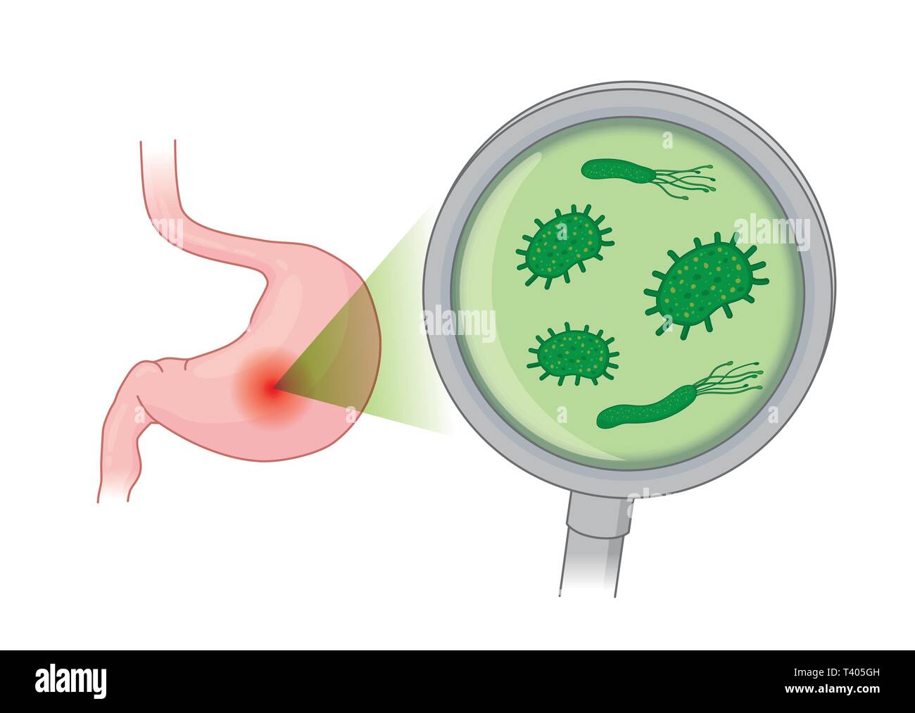 Looking Bacterial in human stomach with with Magnifying glass. Stock Vector