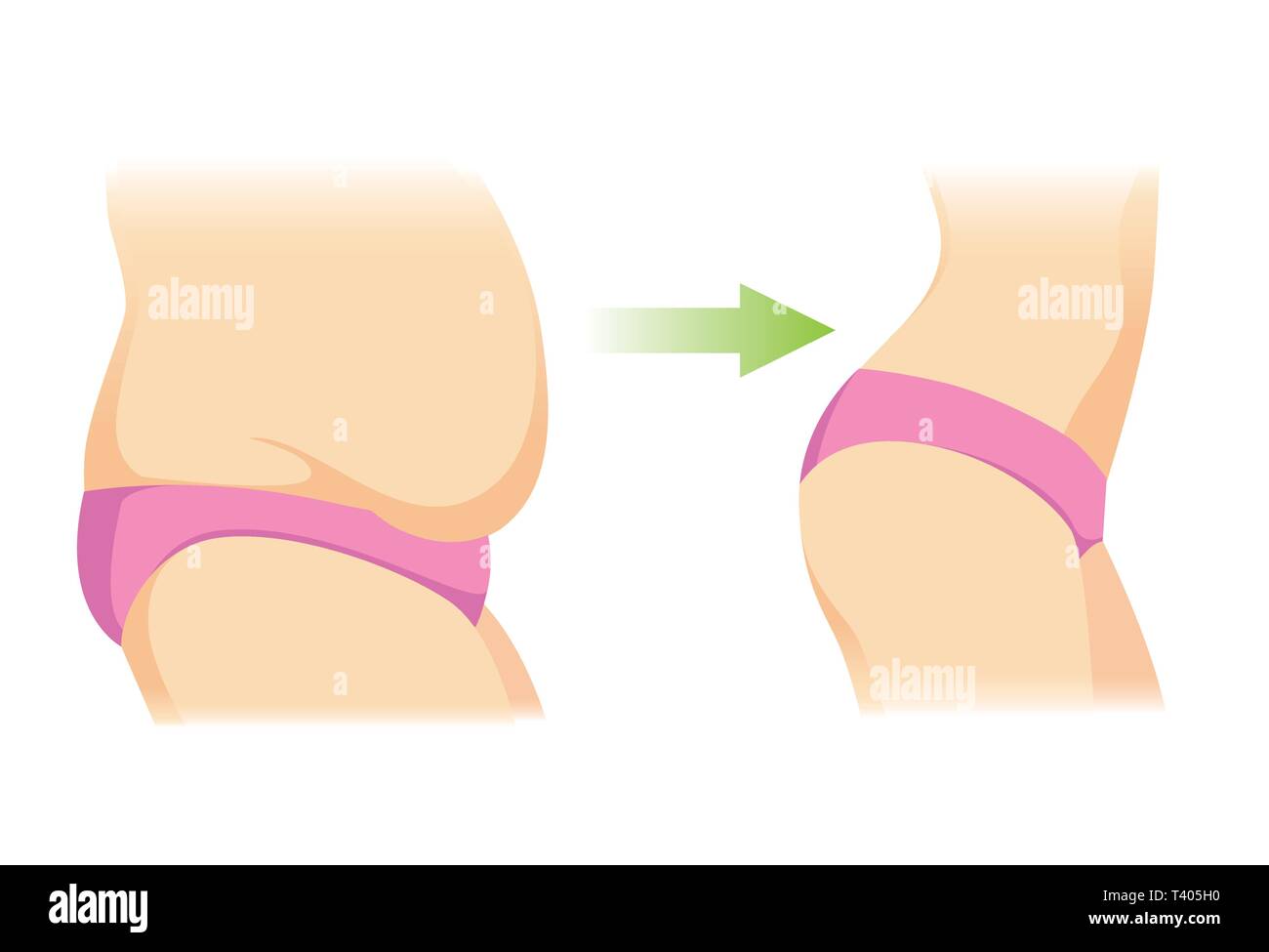 Illustration about transform of Belly Fat to slim. Illustration about body care of woman. Stock Vector