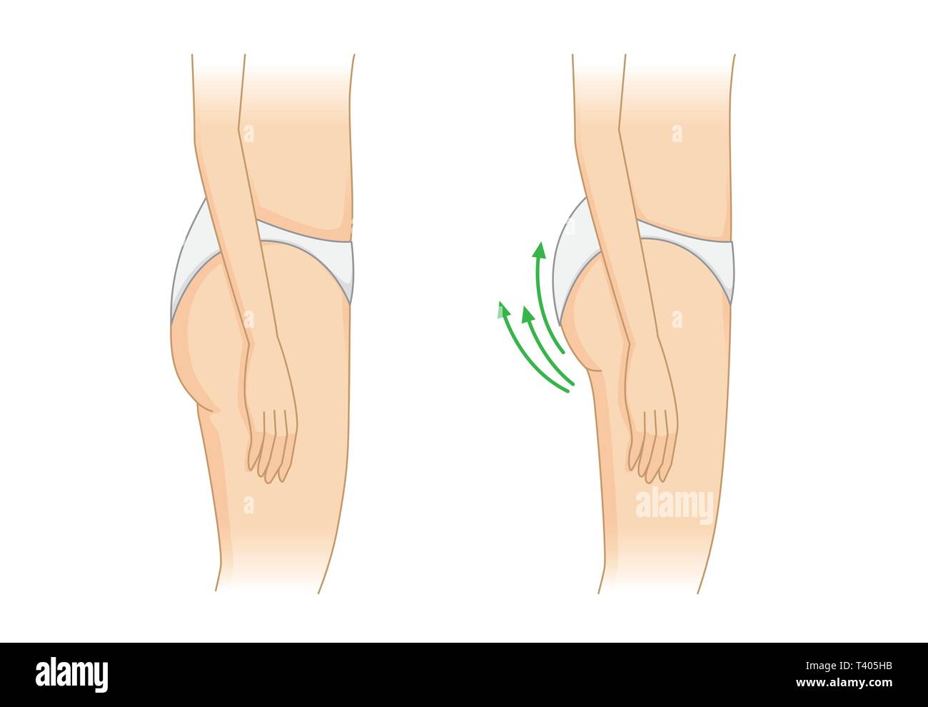 Side view of before and after tightening up buttock. Stock Vector