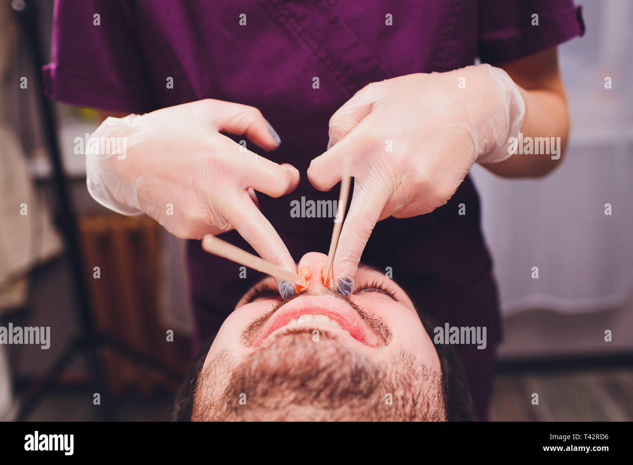 Hair Removal Man S Face Sugaring Epilationsy Ellow Color In