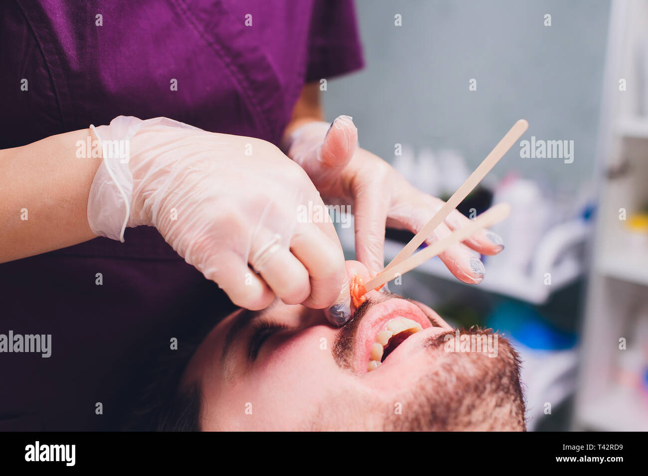 Hair Removal Man S Face Sugaring Epilationsy Ellow Color In