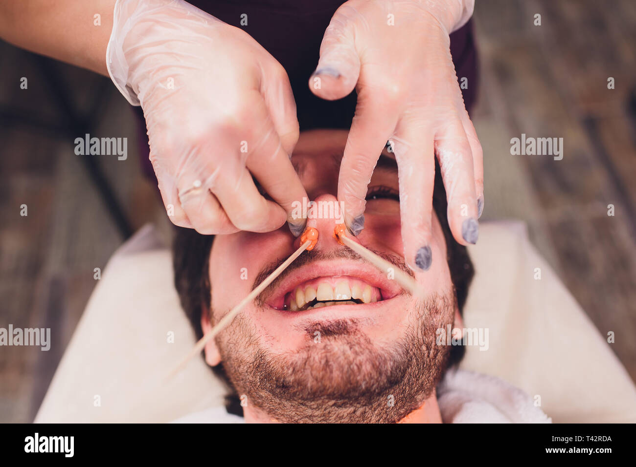 Hair Removal Man S Face Sugaring Epilationsy Ellow Color In