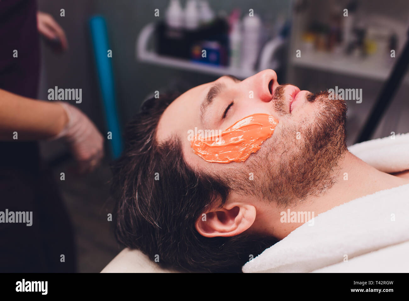 Hair removal. Man's face sugaring epilations beard trimming, yellow color, in cosmetology on the