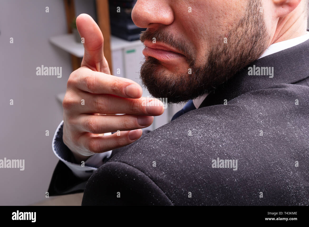 Close-up Of A Businessman Cleaning Dandruff Off The Shoulder Stock Photo