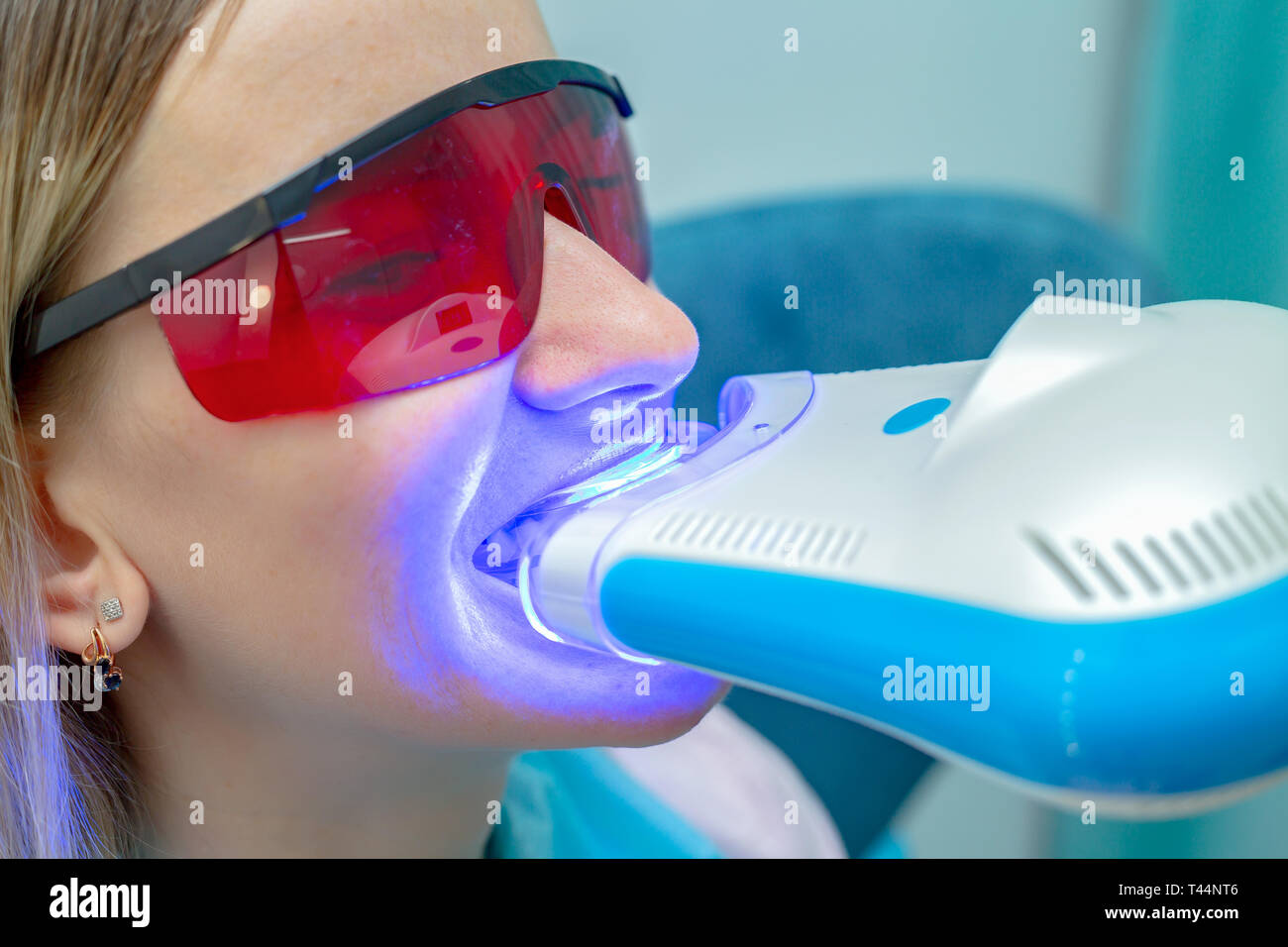 Dental uv hires stock photography and images Alamy