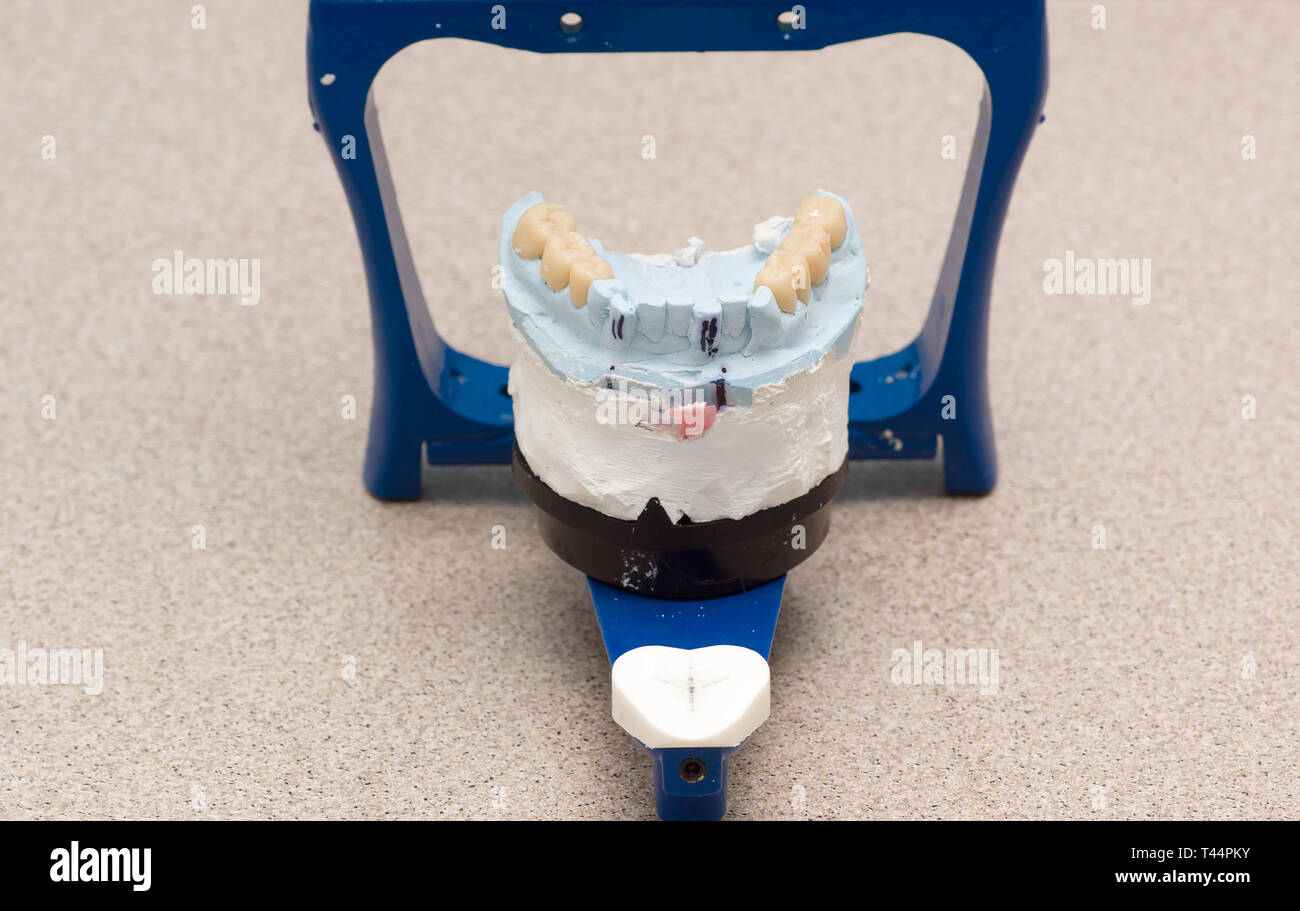 dental articulator with plastered dental bridge models Stock Photo Alamy