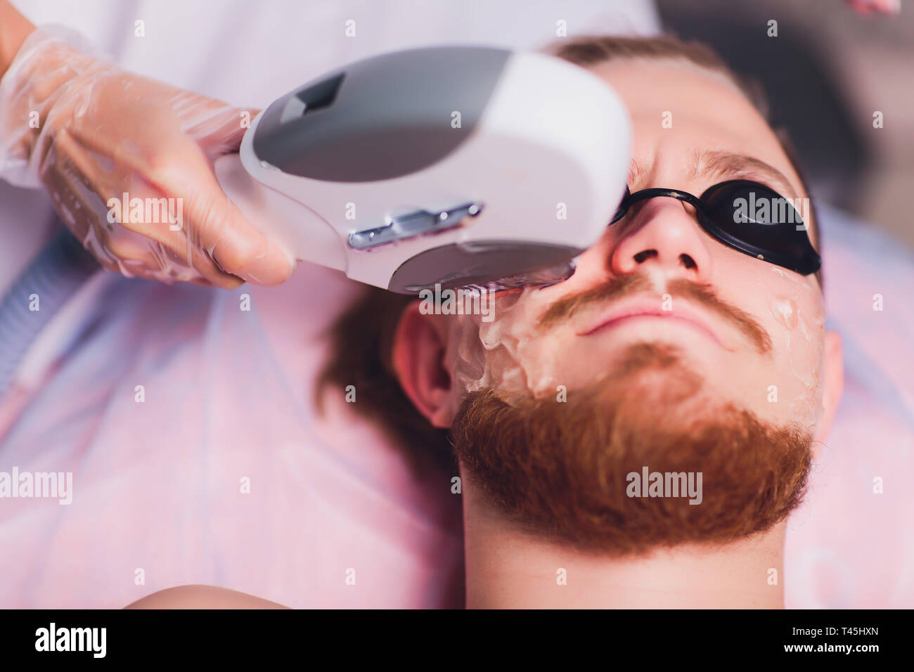 Young Man Receiving Laser Hair Removal Treatment At Beauty Center