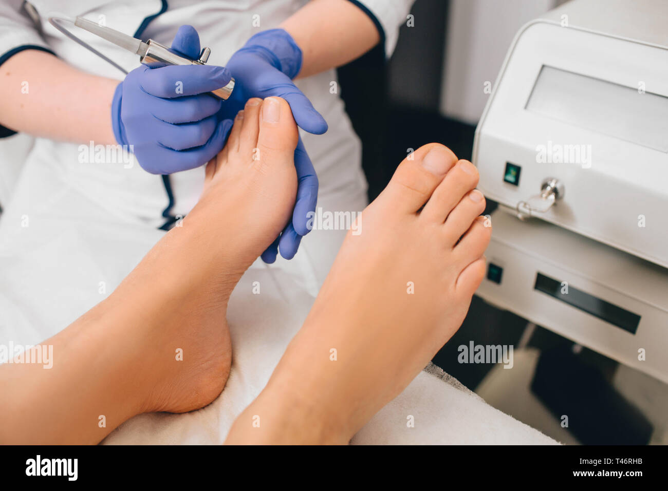 laser treatment on toenail, fungal infection on the toenails Stock Photo