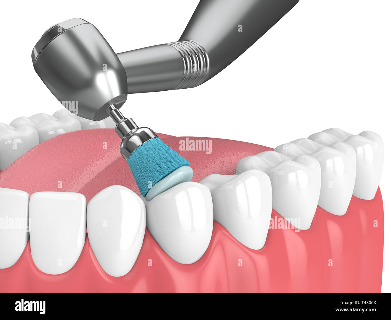 3d render of jaw with dental handpiece and polishing brush. Dental polishing  concept Stock Photo - Alamy