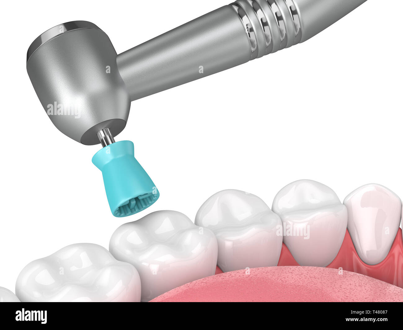 3d render of jaw with dental handpiece and polishing prophy cup. Dental