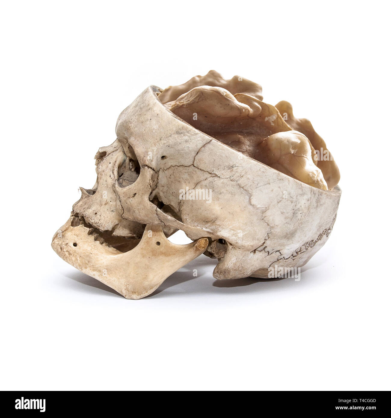 Side view of human skull with walnut instead of brain Stock Photo