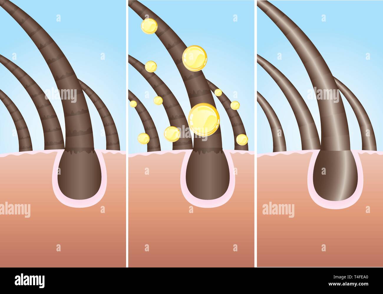 Illustration of three phase of hair cure, vector Stock Vector