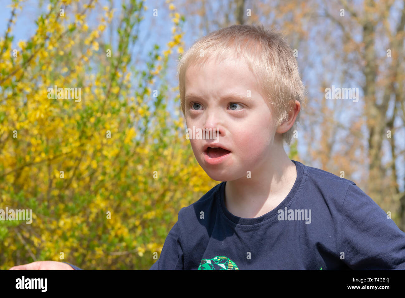 People down syndrome hi-res stock photography and images - Alamy