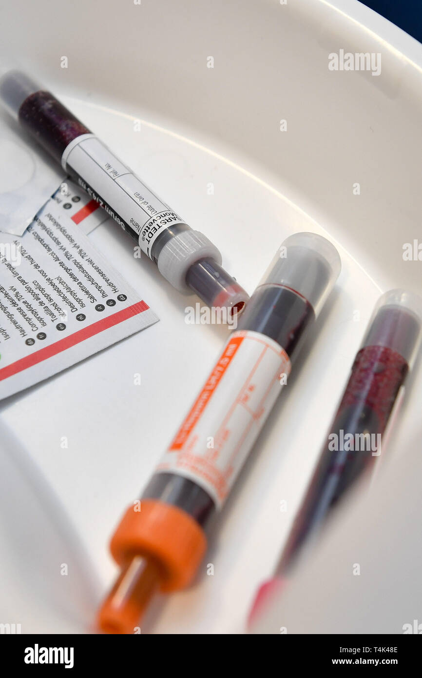 Vials of blood taken from a patient in a medical clinic, based at University of Bristol. PRESS ASSOCIATION Photo. Picture date: Monday April 8, 2019. Photo credit should read: Ben Birchall Stock Photo