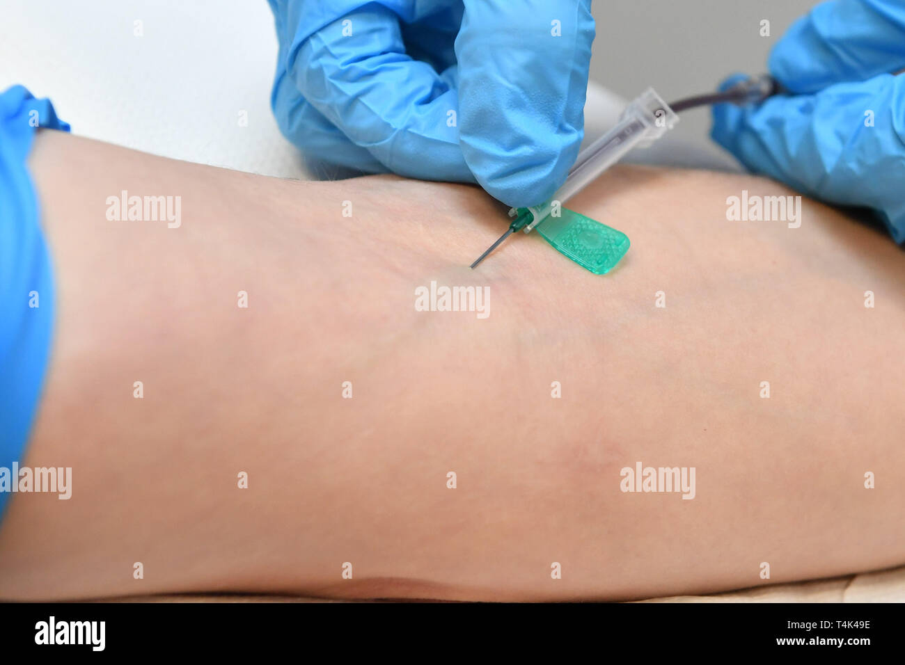 A needle or butterfly cannula is inserted into a vein in an arm to take blood from a patient in a medical clinic, based at University of Bristol. PRESS ASSOCIATION Photo. Picture date: Monday April 8, 2019. Photo credit should read: Ben Birchall Stock Photo