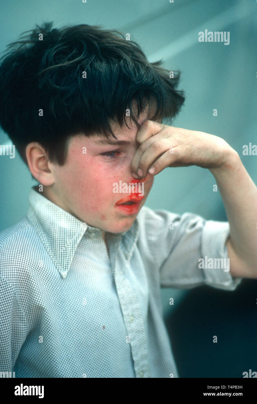 Child with bloody nose after scambling for gifts during Hungerford Hocktide, UK in 1982 Stock Photo