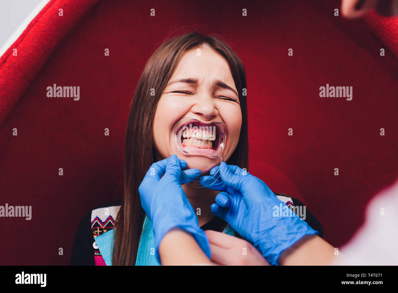 Close up of female mouth with retractor. Doctor flossing the teeth